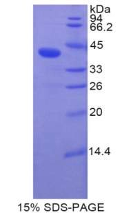 骨成型蛋白10(BMP10)重組蛋白,Recombinant Bone Morphogenetic Protein 10 (BMP10)