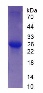 骨骼肌快肌肌钙蛋白I(TNNI2)重组蛋白,Recombinant Troponin I Type 2, Fast Skeletal (TNNI2)