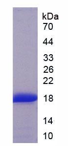 骨骼肌快肌肌鈣蛋白T(TNNT3)重組蛋白,Recombinant Troponin T Type 3, Fast Skeletal (TNNT3)