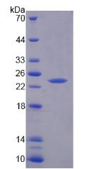 骨骼肌慢肌肌鈣蛋白I(TNNI1)重組蛋白,Recombinant Troponin I Type 1, Slow Skeletal (TNNI1)