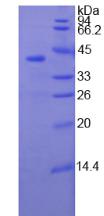 骨骼肌慢肌肌钙蛋白T(TNNT1)重组蛋白,Recombinant Troponin T Type 1, Slow Skeletal (TNNT1)