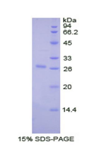 骨桥素(OPN)重组蛋白,Recombinant Osteopontin (OPN)