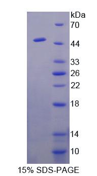 钴胺传递蛋白Ⅱ(TCN2)重组蛋白,Recombinant Transcobalamin II, Macrocytic Anemia (TCN2)