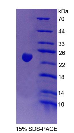 胍乙酸-N-甲基轉移酶(GAMT)重組蛋白,Recombinant Guanidinoacetate-N-Methyltransferase (GAMT)