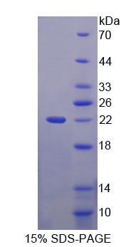 冠層2同源物(CNPY2)重組蛋白,Recombinant Canopy 2 Homolog (CNPY2)