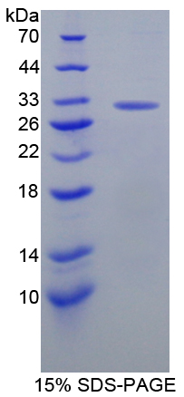 胱天蛋白酶10(CASP10)重组蛋白,Recombinant Caspase 10 (CASP10)