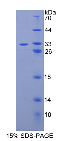 胱天蛋白酶14(CASP14)重组蛋白,Recombinant Caspase 14 (CASP14)