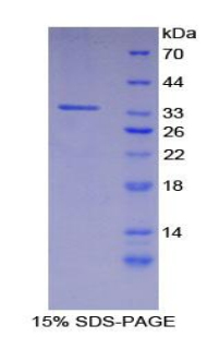 胱天蛋白酶富集域家族成员9(CARD9)重组蛋白,Recombinant Caspase Recruitment Domain Family, Member 9 (CARD9)