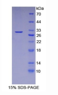 胱天蛋白酶激活脱氧核糖核酸酶(CAD)重组蛋白,Recombinant Caspase Activated DNase (CAD)