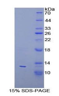 过氧化物酶体生物合成因子2(PEX2)重组蛋白,Recombinant Peroxisomal Biogenesis Factor 2 (PEX2)