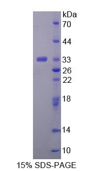 海藻糖酶(TREH)重组蛋白,Recombinant Trehalase (TREH)