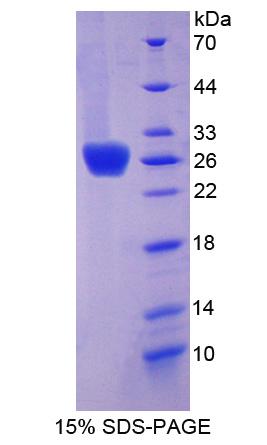 含Ⅰ型血小板域蛋白7A(THSD7A)重组蛋白,Recombinant Thrombospondin Type I Domain Containing Protein 7A (THSD7A)