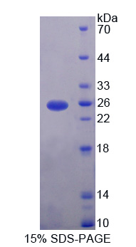 含CUB域蛋白1(CDCP1)重组蛋白,Recombinant CUB Domain Containing Protein 1 (CDCP1)