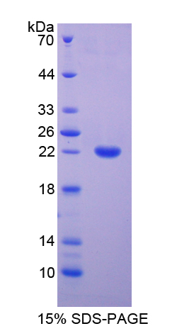 含EGF樣模塊粘蛋白樣激素受體2(EMR2)重組蛋白,Recombinant EGF Like Module Containing Mucin Like Hormone Receptor 2 (EMR2)