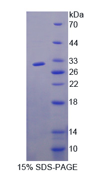 含F(xiàn)-框WD重復(fù)域蛋白7(FBXW7)重組蛋白,Recombinant F-Box And WD Repeat Domain Containing Protein 7 (FBXW7)