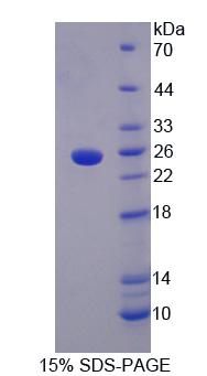 含LETM1域蛋白1(LETMD1)重组蛋白,Recombinant LETM1 Domain Containing Protein 1 (LETMD1)