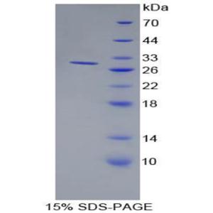 骨髓基质细胞抗原1(BST1)重组蛋白