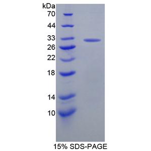 胱天蛋白酶10(CASP10)重组蛋白