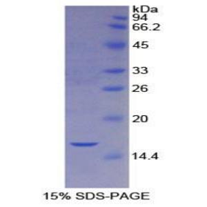 胱天蛋白酶2(CASP2)重组蛋白,Recombinant Caspase 2 (CASP2)