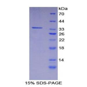 胱天蛋白酶富集域家族成员9(CARD9)重组蛋白,Recombinant Caspase Recruitment Domain Family, Member 9 (CARD9)