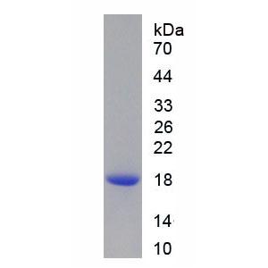 过氧化还原酶2(PRDX2)重组蛋白