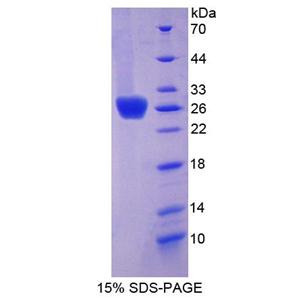 含Ⅰ型血小板域蛋白7A(THSD7A)重组蛋白
