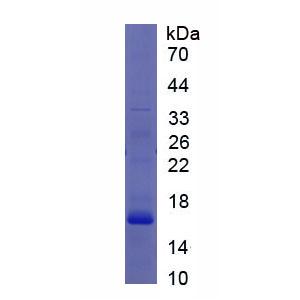 含CASP2和RIPK1域死亡域衔接蛋白(CRADD)重组蛋白