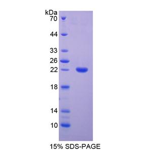 含EGF样模块粘蛋白样激素受体2(EMR2)重组蛋白