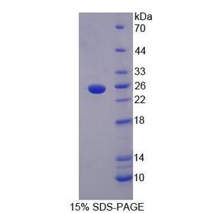 含LETM1域蛋白1(LETMD1)重组蛋白,Recombinant LETM1 Domain Containing Protein 1 (LETMD1)