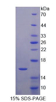 含LIM调宁蛋白同源域蛋白1(LIMCH1)重组蛋白,Recombinant LIM And Calponin Homology Domains Containing Protein 1 (LIMCH1)