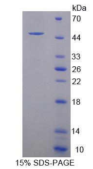 含PR域蛋白14(PRDM14)重组蛋白,Recombinant PR Domain Containing Protein 14 (PRDM14)