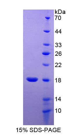 含RCC1和BTB域蛋白2(RCBTB2)重組蛋白,Recombinant RCC1 And BTB Domain Containing Protein 2 (RCBTB2)