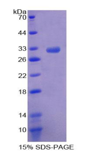 含Rho关联卷曲螺旋蛋白激酶2(Rock2)重组蛋白,Recombinant Rho Associated Coiled Coil Containing Protein Kinase 2 (Rock2)