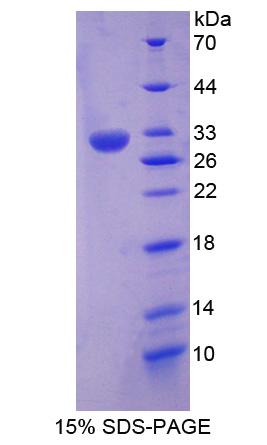 含RNA結(jié)合冷休克域蛋白E1(CSDE1)重組蛋白,Recombinant Cold Shock Domain Containing Protein E1, RNA Binding (CSDE1)