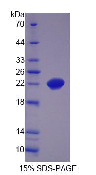 含SCAN域蛋白3(SCAND3)重組蛋白,Recombinant SCAN Domain Containing Protein 3 (SCAND3)