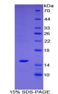 含SH2域蛋白1A(SH2D1A)重組蛋白,Recombinant SH2 Domain Containing Protein 1A (SH2D1A)