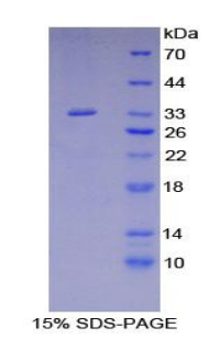 含Src同源物2域適配蛋白B(SHB)重組蛋白,Recombinant Src Homology 2 Domain Containing Adapter Protein B (SHB)