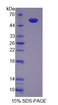 含TCP1伴侣蛋白亚基2(CCT2)重组蛋白,Recombinant Chaperonin Containing TCP1, Subunit 2 (CCT2)