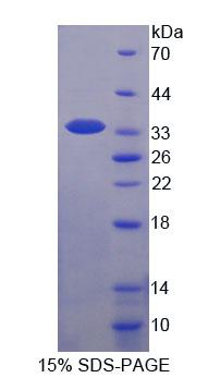 含WW域E3泛素蛋白连接酶2(WWP2)重组蛋白,Recombinant WW Domain Containing E3 Ubiquitin Protein Ligase 2 (WWP2)