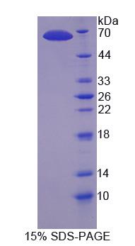 含动力蛋白重链域蛋白1(DNHD1)重组蛋白,Recombinant Dynein Heavy Chain Domain Containing Protein 1 (DNHD1)