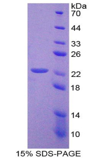 含杆状病毒IAP重复蛋白2(BIRC2)重组蛋白,Recombinant Baculoviral IAP Repeat Containing Protein 2 (BIRC2)