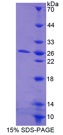 含胶原三螺旋重复蛋白1(CTHRC1)重组蛋白,Recombinant Collagen Triple Helix Repeat Containing Protein 1 (CTHRC1)