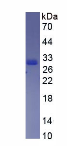 含卷曲螺旋域蛋白60(CCDC60)重组蛋白,Recombinant Coiled Coil Domain Containing Protein 60 (CCDC60)