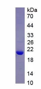 含卷曲螺旋域蛋白80(CCDC80)重組蛋白,Recombinant Coiled Coil Domain Containing Protein 80 (CCDC80)