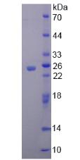 含亮氨酸丰富重复死亡域蛋白(LRDD)重组蛋白,Recombinant Leucine Rich Repeats And Death Domain Containing Protein (LRDD)