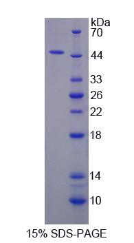 含卵巢癌免疫反应抗原域蛋白2(OCIAD2)重组蛋白,Recombinant Ovarian Cancer Immuno Reactive Antigen Domain Containing Protein 2 (OCIAD2)