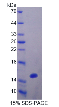 含密封蛋白/ELL域蛋白1(OCEL1)重组蛋白,Recombinant Occludin/ELL Domain Containing Protein 1 (OCEL1)