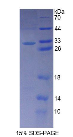 含钯蛋白(PALLD)重组蛋白,Recombinant Palladin (PALLD)