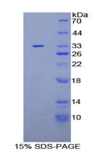 含普列克底物同源物域家族A成员1(PLEKHA1)重组蛋白,Recombinant Pleckstrin Homology Domain Containing Family A, Member 1 (PLEKHA1)