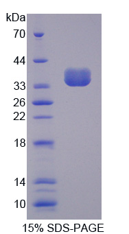 含缬酪肽蛋白(VCP)重组蛋白,Recombinant Valosin Containing Protein (VCP)